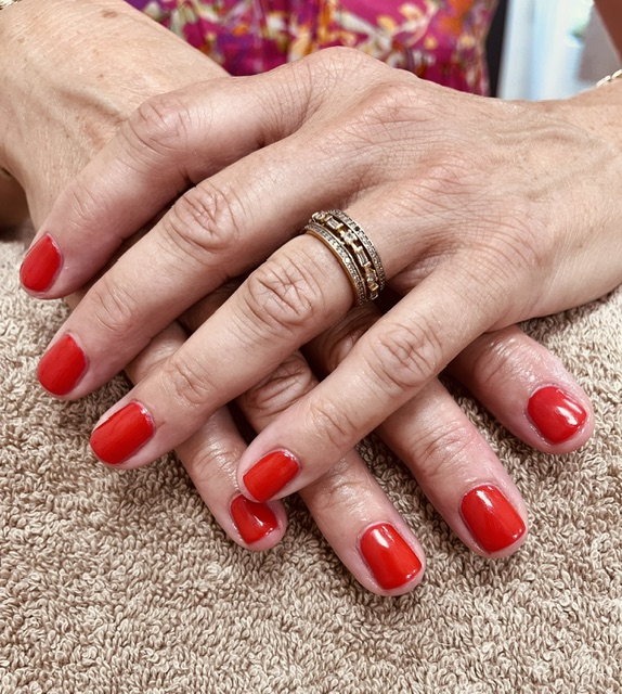 Ongles