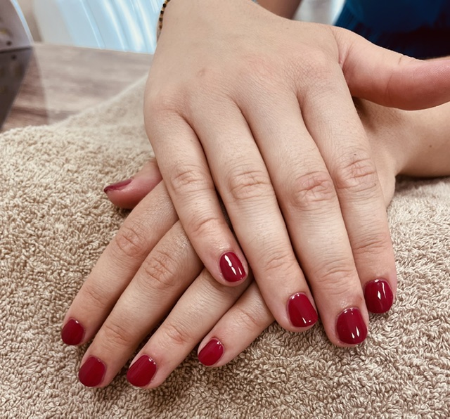 Ongles