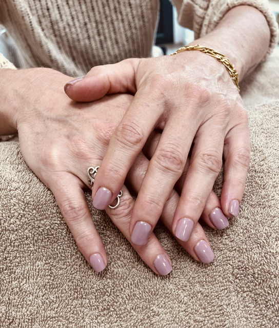 Ongles